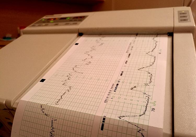 Kardiotokografie im Krankenhaus (Archiv), via dts Nachrichtenagentur